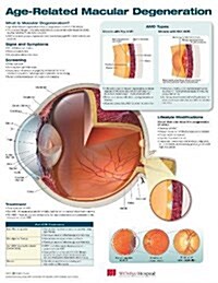 Age-Related Macular Degeneration (Other)