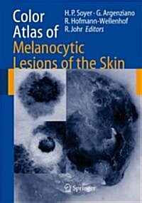 Color Atlas of Melanocytic Lesions of the Skin (Hardcover)