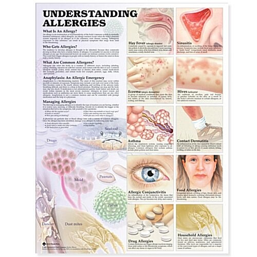 Understanding Allergies Anatomical Chart (Chart)
