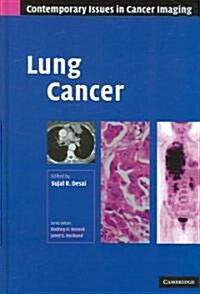 Lung Cancer (Hardcover)
