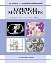 Lymphoid Malignancies (Hardcover)