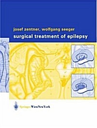 Surgical Treatment of Epilepsy (Hardcover)