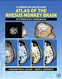 A Combined MRI and Histology Atlas of the Rhesus Monkey Brain in Stereotaxic Coordinates (Paperback, 1st, Spiral)