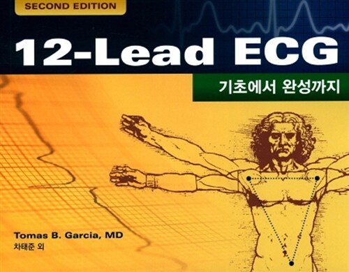 12 - Lead ECG