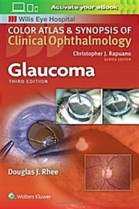 Glaucoma (Paperback)