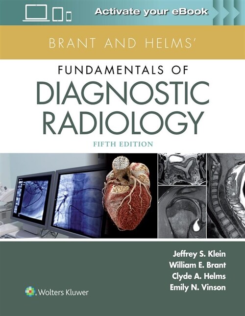 Brant and Helms Fundamentals of Diagnostic Radiology (Hardcover)