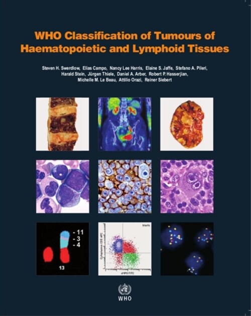 [중고] Who Classification of Tumours of Haematopoietic and Lymphoid Tissues (Paperback, 4, Revised)