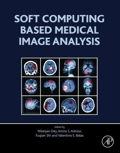 Soft Computing Based Medical Image Analysis (Paperback)