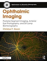 Ophthalmic Imaging : Posterior Segment Imaging, Anterior Eye Photography, and Slit Lamp Biomicrography (Paperback)