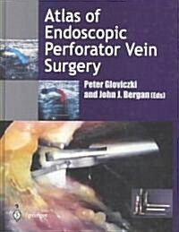 Atlas of Endoscopic Perforator Vein Surgery (Hardcover)