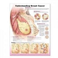 Understanding Breast Cancer Anatomical Chart (Chart, 2nd)