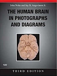 The Human Brain in Photographs and Diagrams (Paperback, 3rd, Spiral)