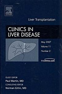 Liver Transplantation (Hardcover, 1st)