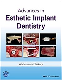 Advances in Esthetic Implant Dentistry (Hardcover)