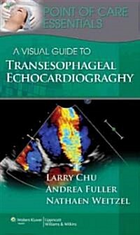 A Visual Guide to Transesophageal Echocardiography (Spiral)