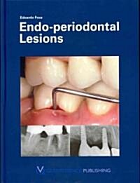 Endo-Periodontal Lesions (Hardcover)
