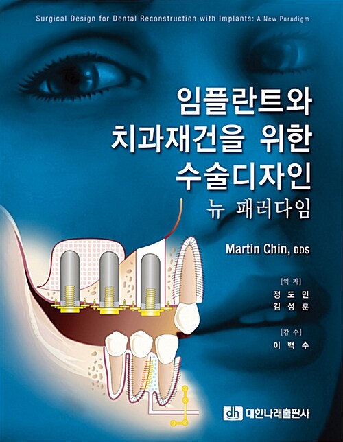 임플란트와 치과재건을 위한 수술 디자인