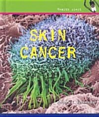 Skin Cancer (Library Binding)