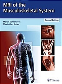 MRI of the Musculoskeletal System (Hardcover, 2)