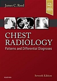 Chest Radiology: Patterns and Differential Diagnoses (Hardcover, 7)