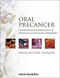 Oral Precancer: Diagnosis and Management of Potentially Malignant Disorders (Hardcover)