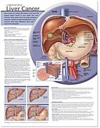 Understanding Liver Cancer Anatomical Chart (Chart)