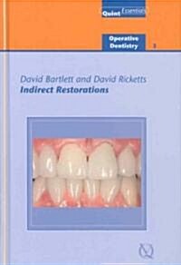 Indirect Restorations (Hardcover)