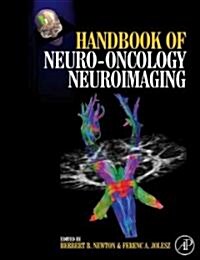Handbook of Neuro-Oncology Neuroimaging (Hardcover)