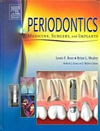 [중고] Periodontics (Hardcover)