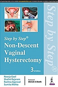 Step by Step: Non-Descent Vaginal Hysterectomy (Paperback, 3)