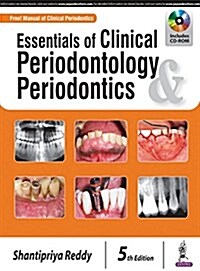 Essentials of Clinical Periodontology & Periodontics (Paperback, 5)