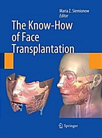 The Know-How of Face Transplantation (Paperback, Softcover reprint of the original 1st ed. 2011)