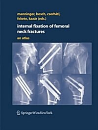 Internal Fixation of Femoral Neck Fractures: An Atlas (Paperback, Softcover Repri)
