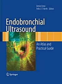 Endobronchial Ultrasound: An Atlas and Practical Guide (Paperback, Softcover Repri)