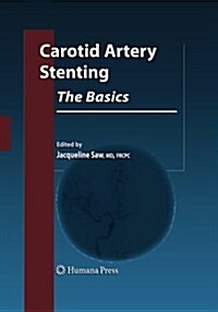 Carotid Artery Stenting: The Basics (Paperback, Softcover Repri)