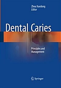 Dental Caries: Principles and Management (Paperback, Softcover Repri)
