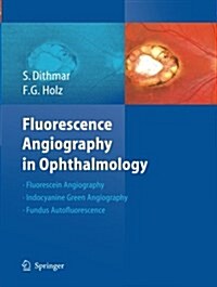 Fluorescence Angiography in Ophthalmology (Paperback, Softcover Repri)