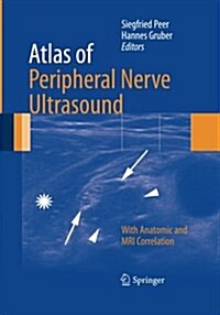 Atlas of Peripheral Nerve Ultrasound: With Anatomic and MRI Correlation (Paperback, Softcover Repri)