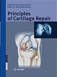 Principles of Cartilage Repair (Paperback, Softcover Repri)
