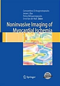 Noninvasive Imaging of Myocardial Ischemia (Paperback, Softcover reprint of the original 1st ed. 2006)