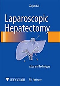 Laparoscopic Hepatectomy: Atlas and Techniques (Paperback, Softcover Repri)