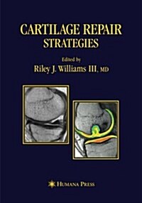 Cartilage Repair Strategies (Paperback, Softcover Repri)
