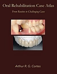 Oral Rehabilitation Case Atlas: From Routine to Challenging Cases (Paperback)