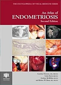 An Atlas of Endometriosis, Second Edition (2nd, Hardcover)