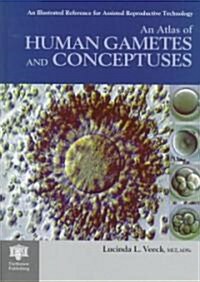 An Atlas of Human Gametes and Conceptuses : An Illustrated Reference for Assisted Reproductive Technology (Hardcover)