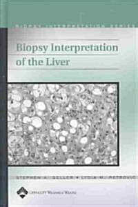 Biopsy Interpretation of the Liver (Hardcover, CD-ROM)