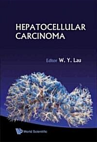 Hepatocellular Carcinoma (Hardcover)