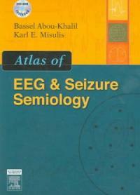 Atlas of EEG & seizure semiology
