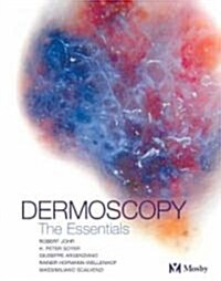 Dermoscopy (Paperback)