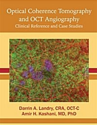 Optical Coherence Tomography and Oct Angiography: Clinical Reference and Case Studies (Paperback)